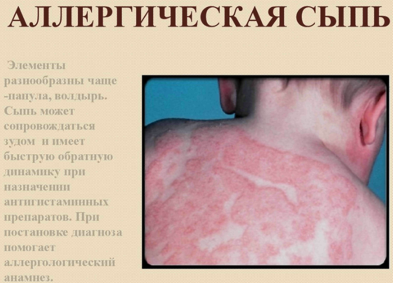 Симптомы проблем с печенью, которые легко заметить - 20 августа - fitdiets.ru